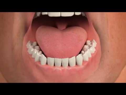 Embedded thumbnail for Prosthodontics