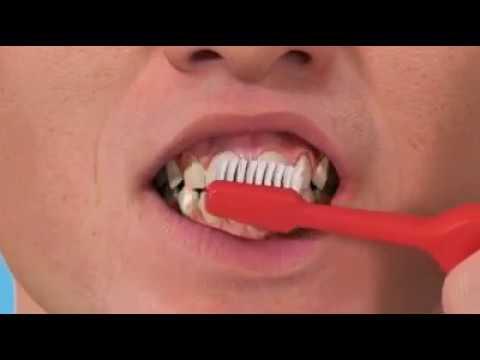Embedded thumbnail for Programi i Higjenës Dentare